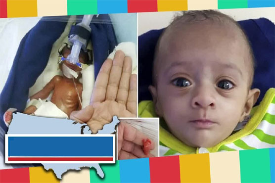وہ بچی جس کا بچنا ناممکن قرار دیا گیا